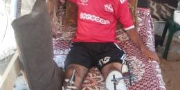 ابراهيم العرجا.. نجم فلسطيني أطفأت الحرب قدميه وأشعلت وجعه